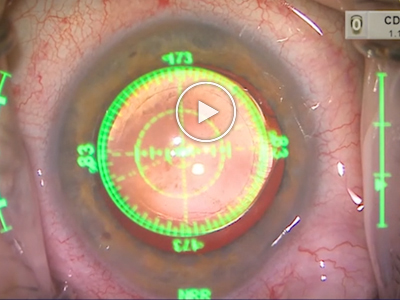 surgical-practice-video